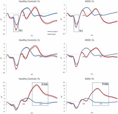 Electrophysiological biomarkers and age characterize phenotypic heterogeneity among individuals with major depressive disorder